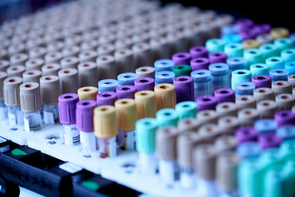 Rows of blood sample tubes with coloured caps in a laboratory rack